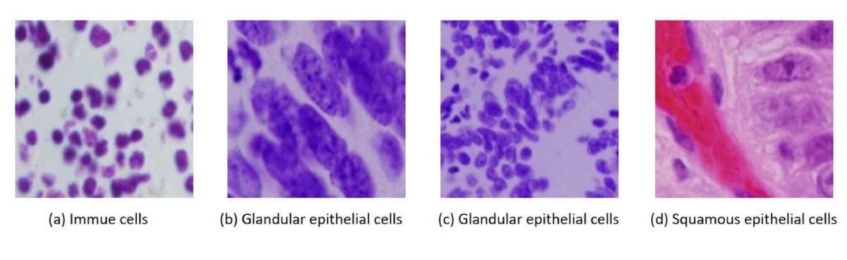 IntelligentMed8's tweet image. Keywords
Image Segmentation, Deep Learning, Image Analysis, U-Net++, Watershed, GUI