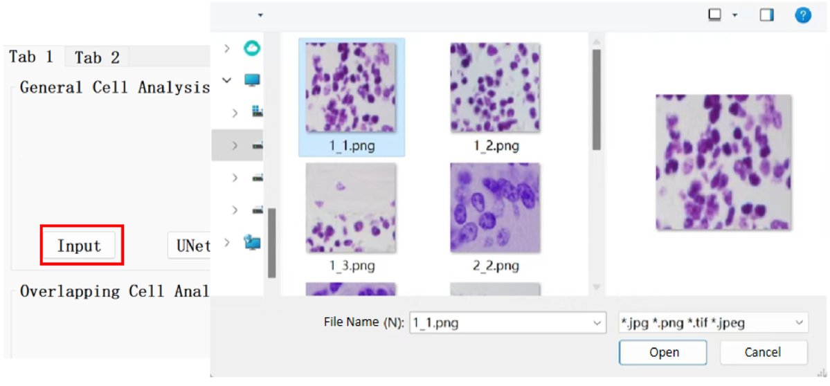 IntelligentMed8's tweet image. Keywords
Image Segmentation, Deep Learning, Image Analysis, U-Net++, Watershed, GUI