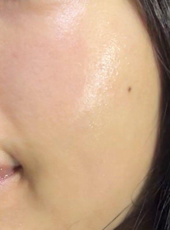 ✨EVENT✨

季節の変わり目にはいつも肌バランスが崩れちゃう敏感肌の中の人😣
でも今年はPDRNカプセルクリームでツヤツヤ光彩溢れるお肌になりました！

植物性PDRNがカプセルに凝縮💆🏻‍♀️
ライトジェルにはペプチド・パンテノール・スクワランが配合され、水分・肌バランスケアを🫗