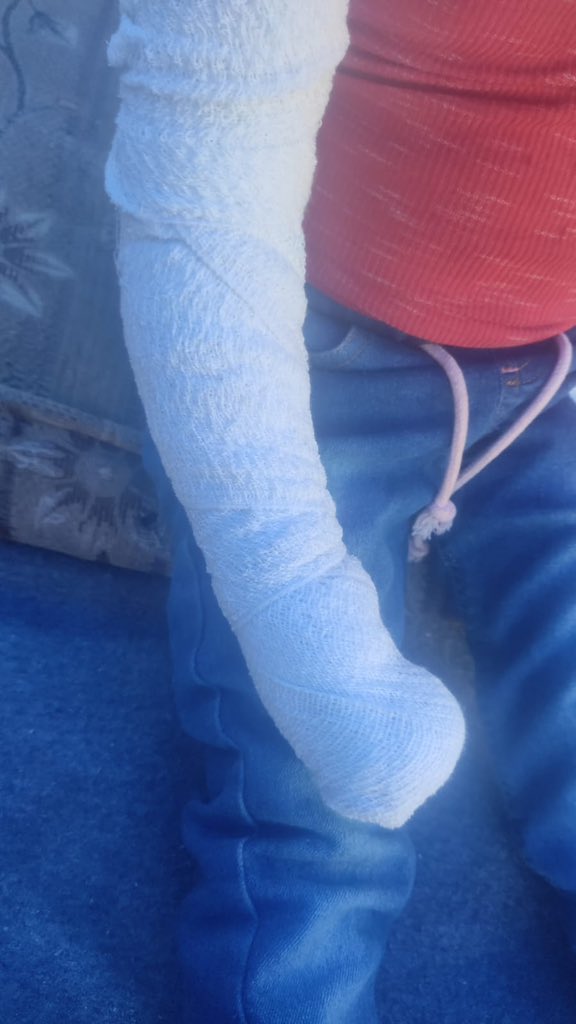 ZERODS6's tweet photo. Selamünaleyküm kardeşlerim, inşallah Allah'tan sonra kardeşlerim ablamın operasyonu 29 Ekim'de olacak, kız kardeşimi kurtarmamıza yardım edin, tedaviye ve operasyona ihtiyacı var, bağışınız onu kurtaracak, basit de olsa katılın, Diala'yı kurtarın🙏

https://t.co/CXrcj4lyfb https://t.co/DCsAjxaAd1
