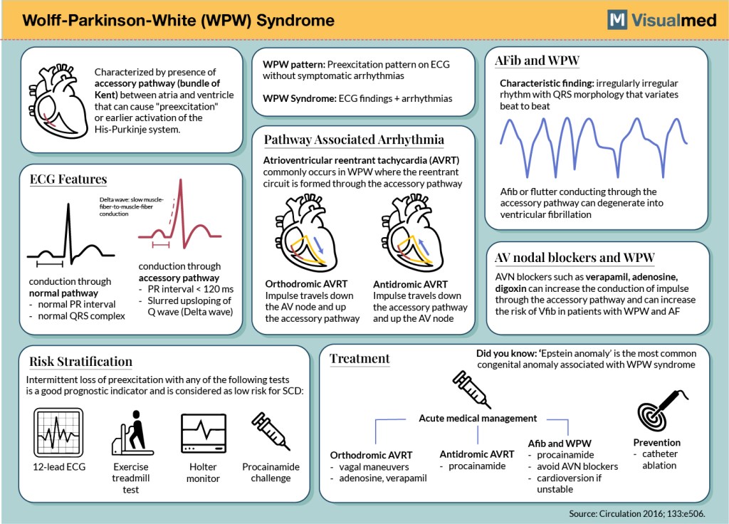 TrackYourHeart's tweet image. WPW Pattern vs. WPW Syndrome

🔲 WPW Pattern: Identified by classic ECG findings:
- Short PR interval, delta wave, and wide QRS but the patient remains asymptomatic with no documented arrhythmias.

🔲 WPW Syndrome: Not just the ECG pattern, but symptomatic tachyarrhythmias (e.g.,…