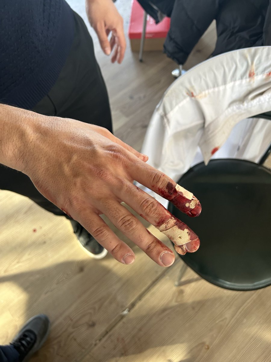 HacettepeTMT's tweet photo. Hacettepe Üniversitesinde TÜRK bayrağına saldıran, TÜRK milliyetçisi gençleri dünden beri ölümle tehdit eden bölücü örgüt mensupları bugün akşam saatlerinde ortada hiçbir neden olmaksızın bir anda Nacho Cafeye yönelmişler içerde kimin olduğuna bakmaksızın -kadın, çocuk ve çalışanlar- içeriye taş, soda şişesi ve demir sopalarla saldırmışlardır. Öğrenci Kolektifleri olarak bilinen grup ise "faşistlere ölüm" pankartı açmışlar faşistleri istemiyoruz paylaşımı yaparak saldırıyı sahiplenmiştir. Milliyetçiler öğrenciler de kendilerini savununca "faşistler bize saldırdı" yalanıyla sosyal medyayı ve üniversiteyi manipüle etmişlerdir. Yaptıkları alçakça saldırı amacına ulaşmadığı için sosyal medya gerillacılığı yoluna geçmişlerdir.