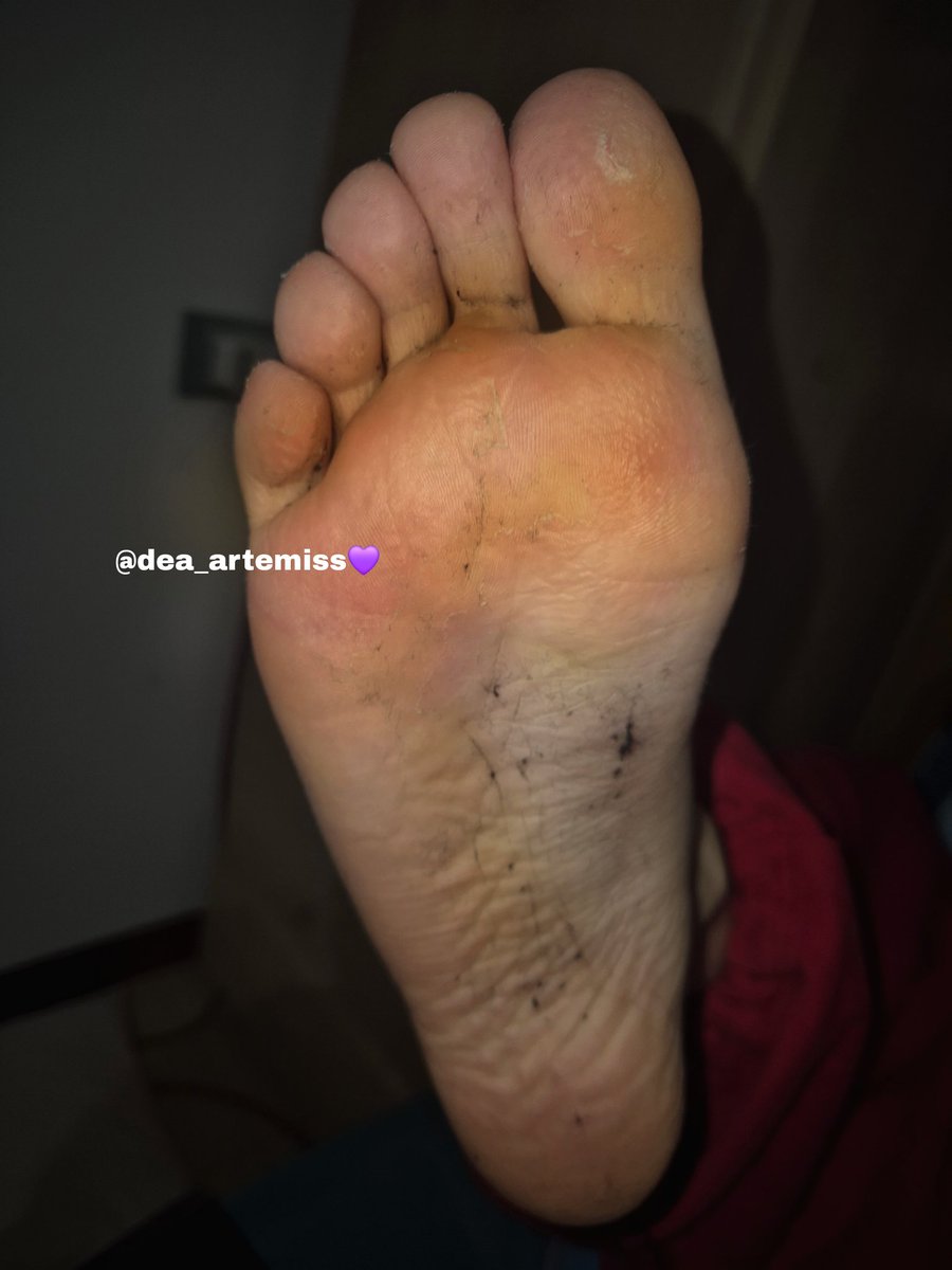 Do you prefer clean or extremely stinky feet? 😷🤢💀