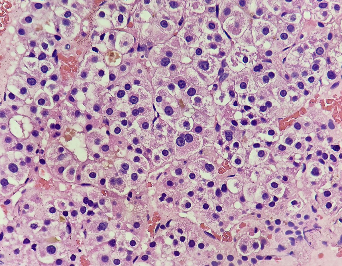padmapathology1's tweet photo. #PathTwitter #pathX
#liverpath
ππ
#TooCuteNotToShare
#pathresidents https://t.co/XDXGTEMC1p