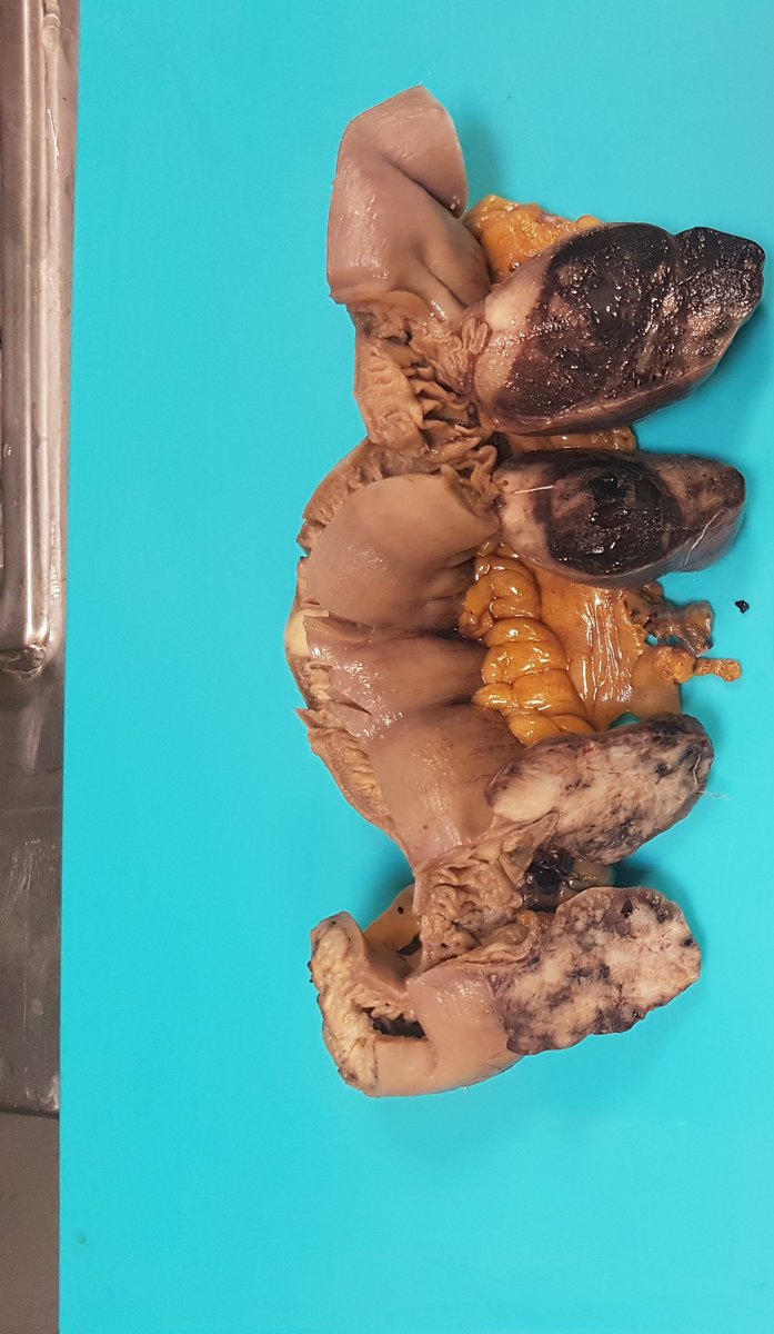 SedaKcShn's tweet photo. Ülkemizde CERRAHİ PATOLOJİ uygulanmaktadır. #patolojicerrahiklinikbranştır
@saglikbakanligi @drmemisoglu @tcbestepe @pembeoltulu @OlgerHatice https://t.co/Vcb6yD8C2v