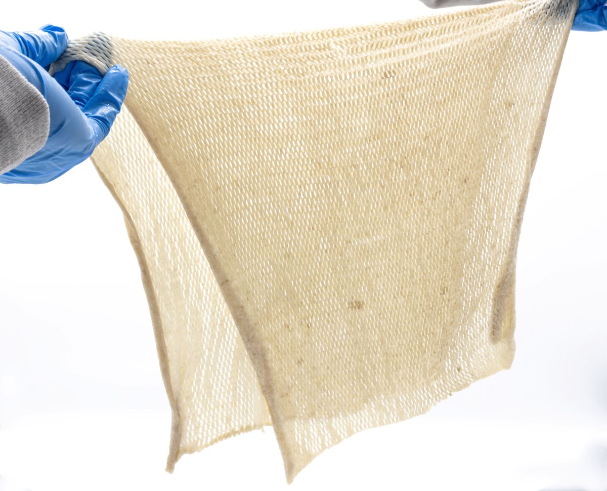 AlloSource is advancing #burncare with PureSkin XL – an extra-large skin graft solution. Discover how we're expanding treatment options for  #burnmanagement. Learn more: brnw.ch/21wRB5b.