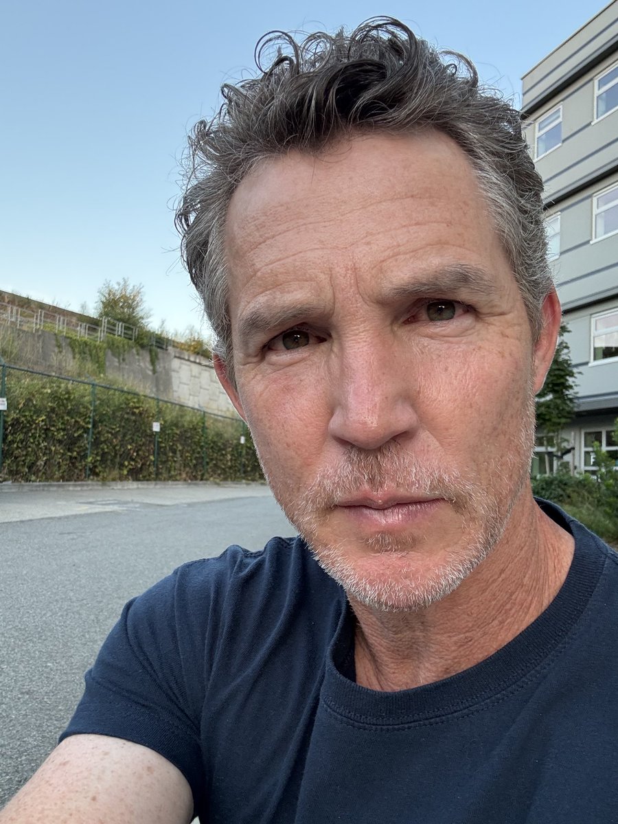 his eyes are bloodshot af 😭😭 get some rest king