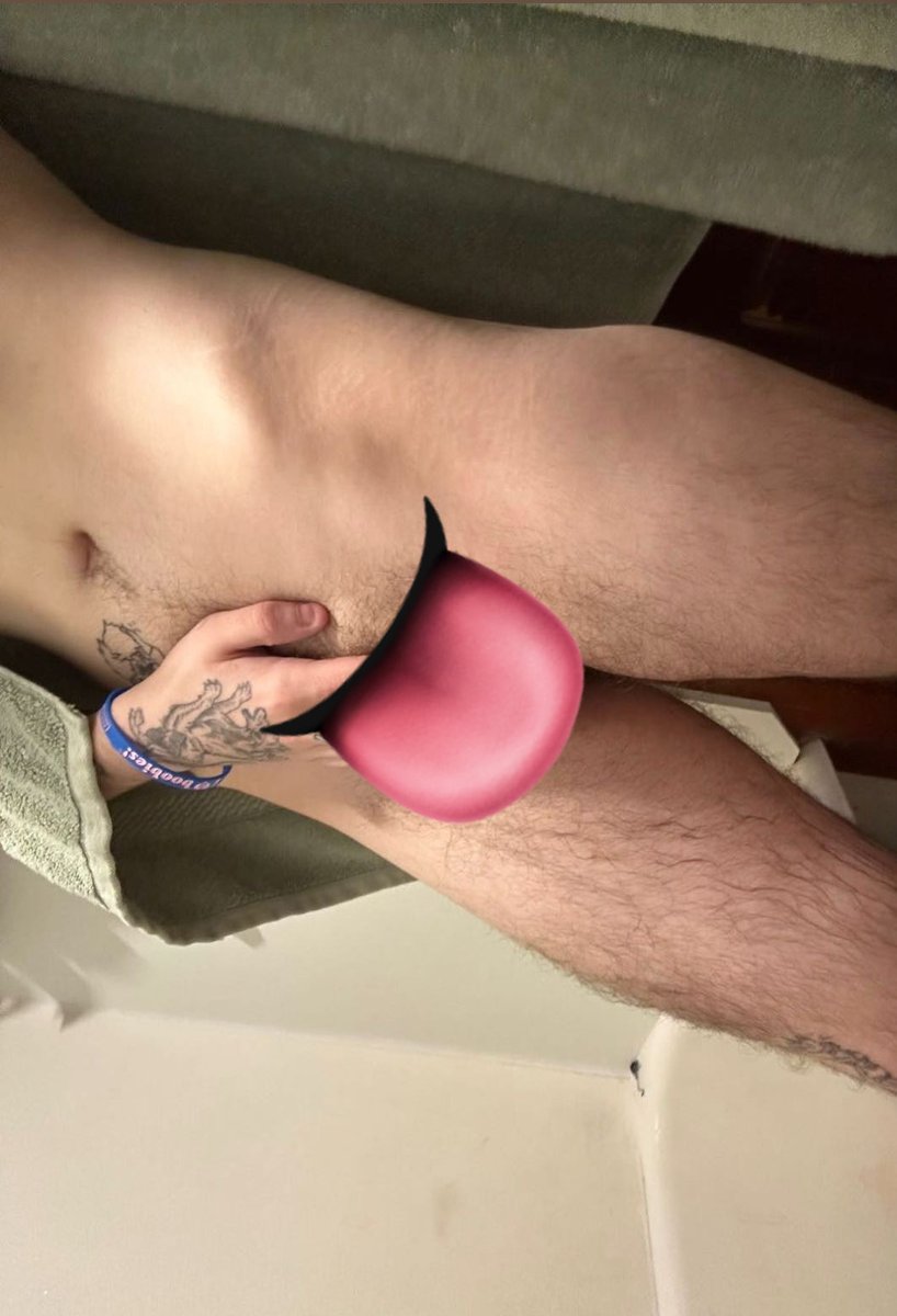 Forest🌲😾 tweet media