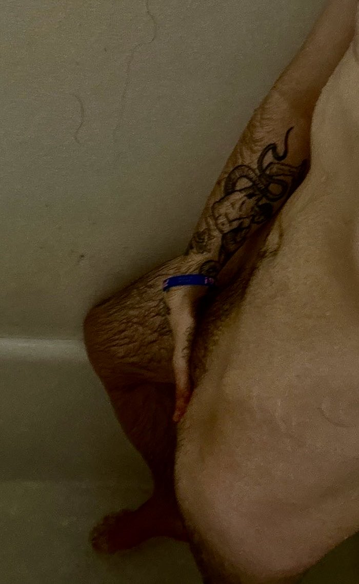 Forest🌲😾 tweet media