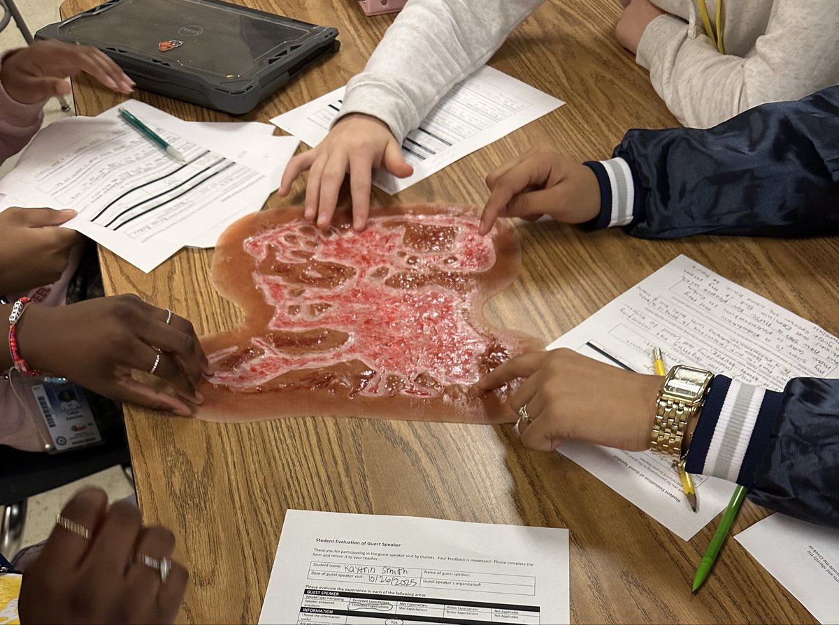Proud mom moment 💙 My medical terminology students learned about wound care and burns from my daughter, Brilyn Baker, BSN, RN, CCRN, CBRN — a Burn ICU nurse at Parkland. So proud of you for sharing your passion! 👩‍⚕️🔥<a href="/ParkhillJH/">Parkhill Junior High</a> <a href="/Parkland/">Parkland Health</a> #risddreambig #pjhdreambig