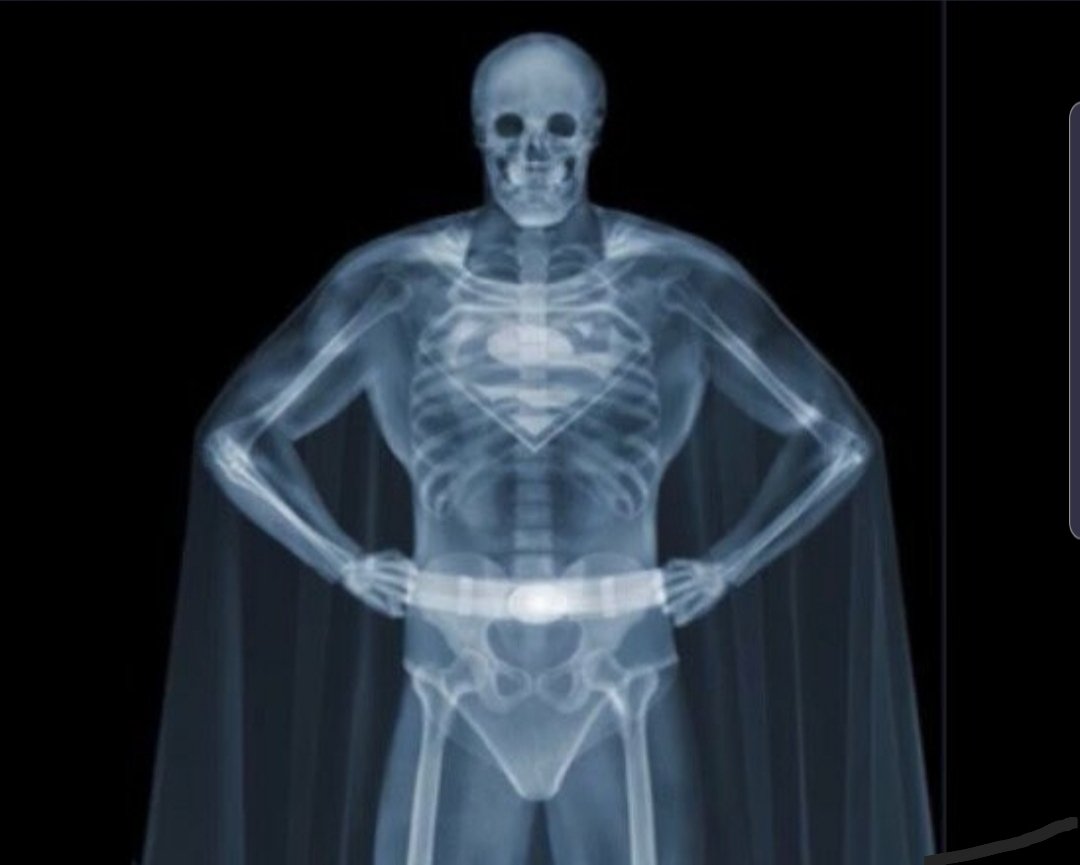 Trash_Man84's tweet photo. @LeadingReport his xray was even better https://t.co/yMFM2gsU5v