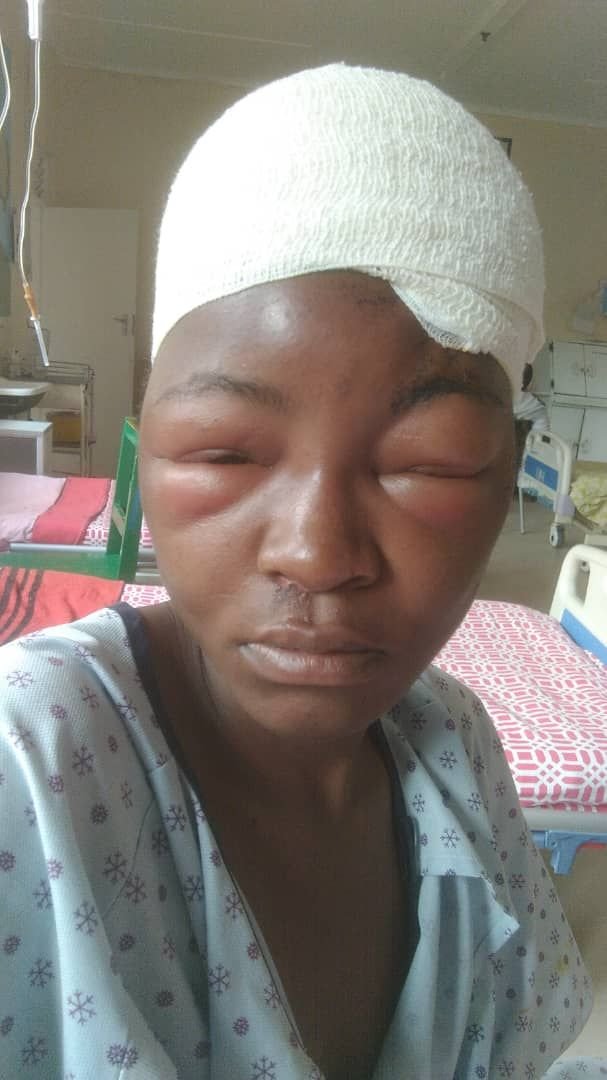 Pihwai mota, asi iwe neni zvichatiwana chete. We are busy moving this young lady nemwana wake from one of the rural hospitals, hakuna mushonga. She got involved in a combi accident; mwana wake, 6 years old, has broken bones. Iye, she suffered a head injury. Tete and sekuru died