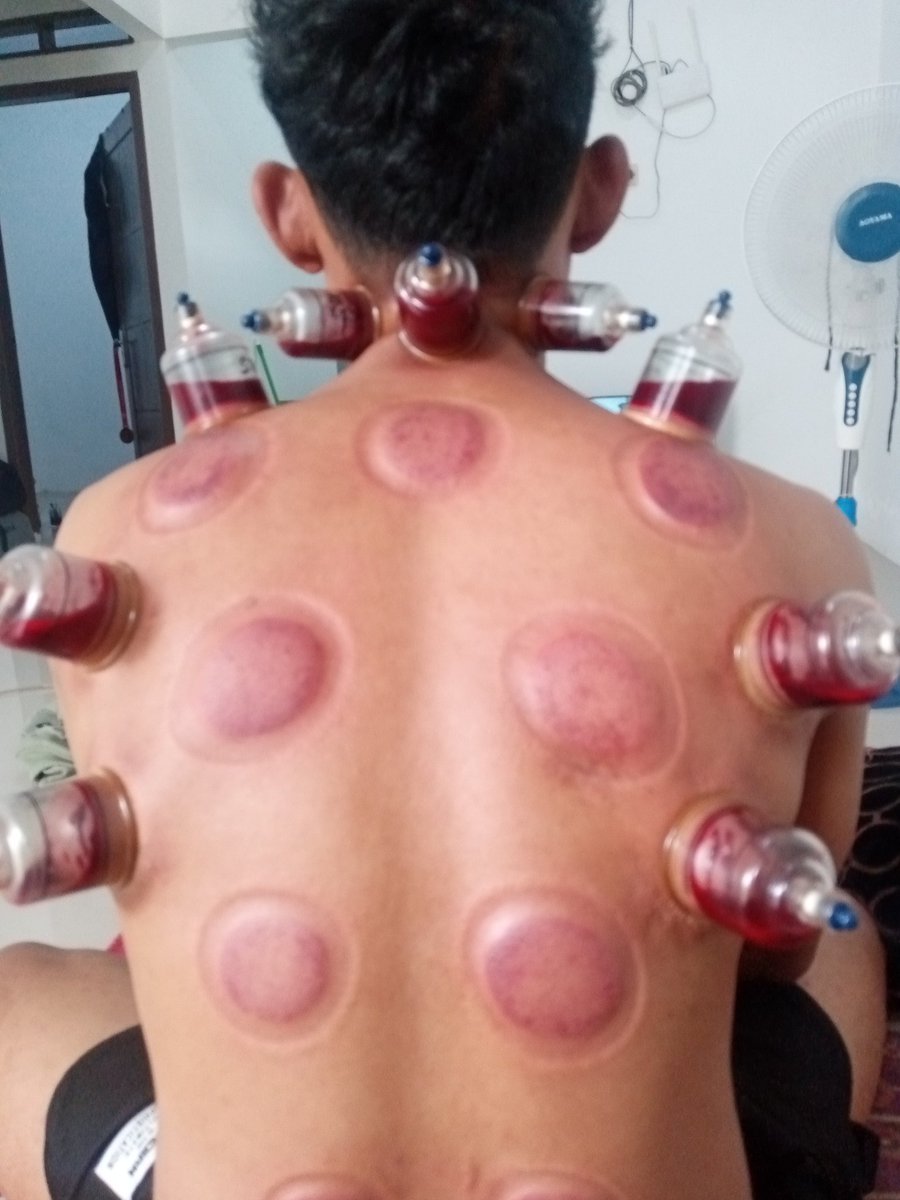 MbuyPijit's tweet photo. Yukk jadwal kan..
Full body massage 
Reflexy 
Kop angin
Bekam
Totok wajah
Kerikan
Lulur body scrub 
089605467846 Bogor
@AnggaYouth @JoshBogorad https://t.co/biRuaFNi60