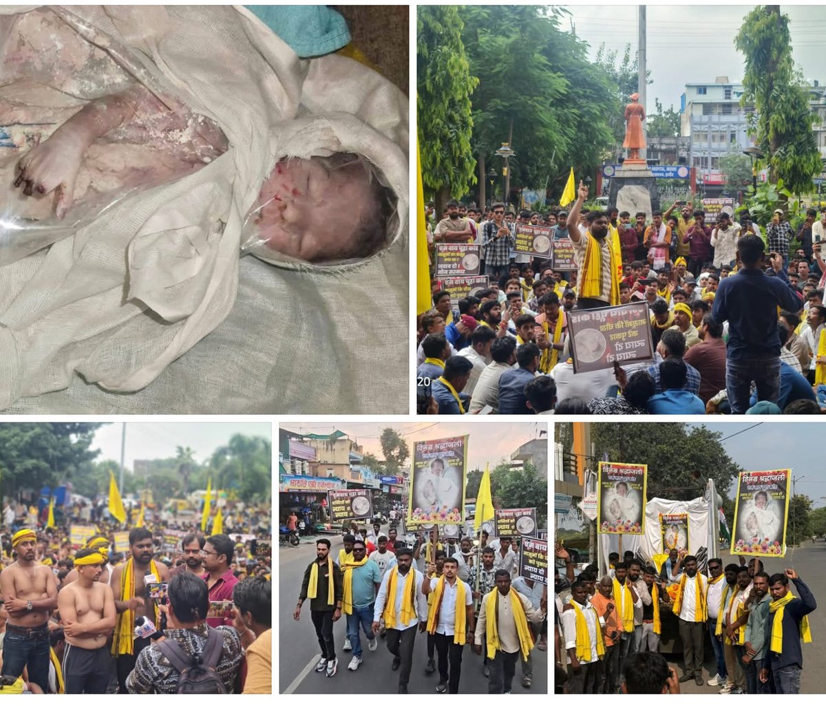 एमवाय चूहा कांड पर अब भी कार्रवाई नहीं!
डीन-अधीक्षक दोषी, फिर भी सरकार चुप!
जयस ने आंदोलन व न्याय यात्रा से चेताया था 
अब नहीं रुकेगा, जल्द होगा जनआंदोलन का महाप्रहार! 

#JAYS #JusticeForPatients #MYHospital #जनआंदोलन
<a href="/CMMadhyaPradesh/">Chief Minister, MP</a> <a href="/DrMohanYadav51/">Dr Mohan Yadav</a>  <a href="/PMOIndia/">PMO India</a> <a href="/narendramodi/">Narendra Modi</a>