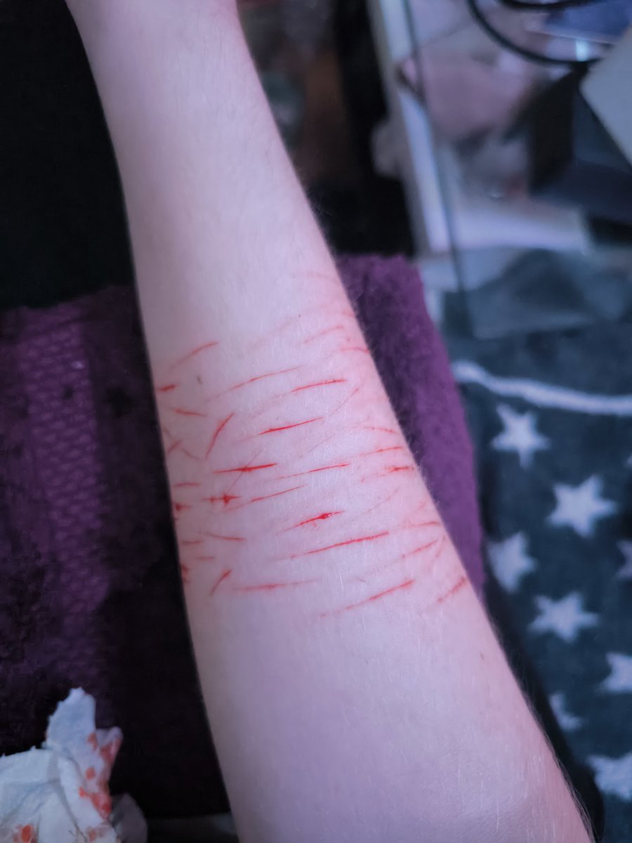 asidsorderr's tweet photo. I'll try deeper next time before someone judges😣 https://t.co/K6PKhDxAIH