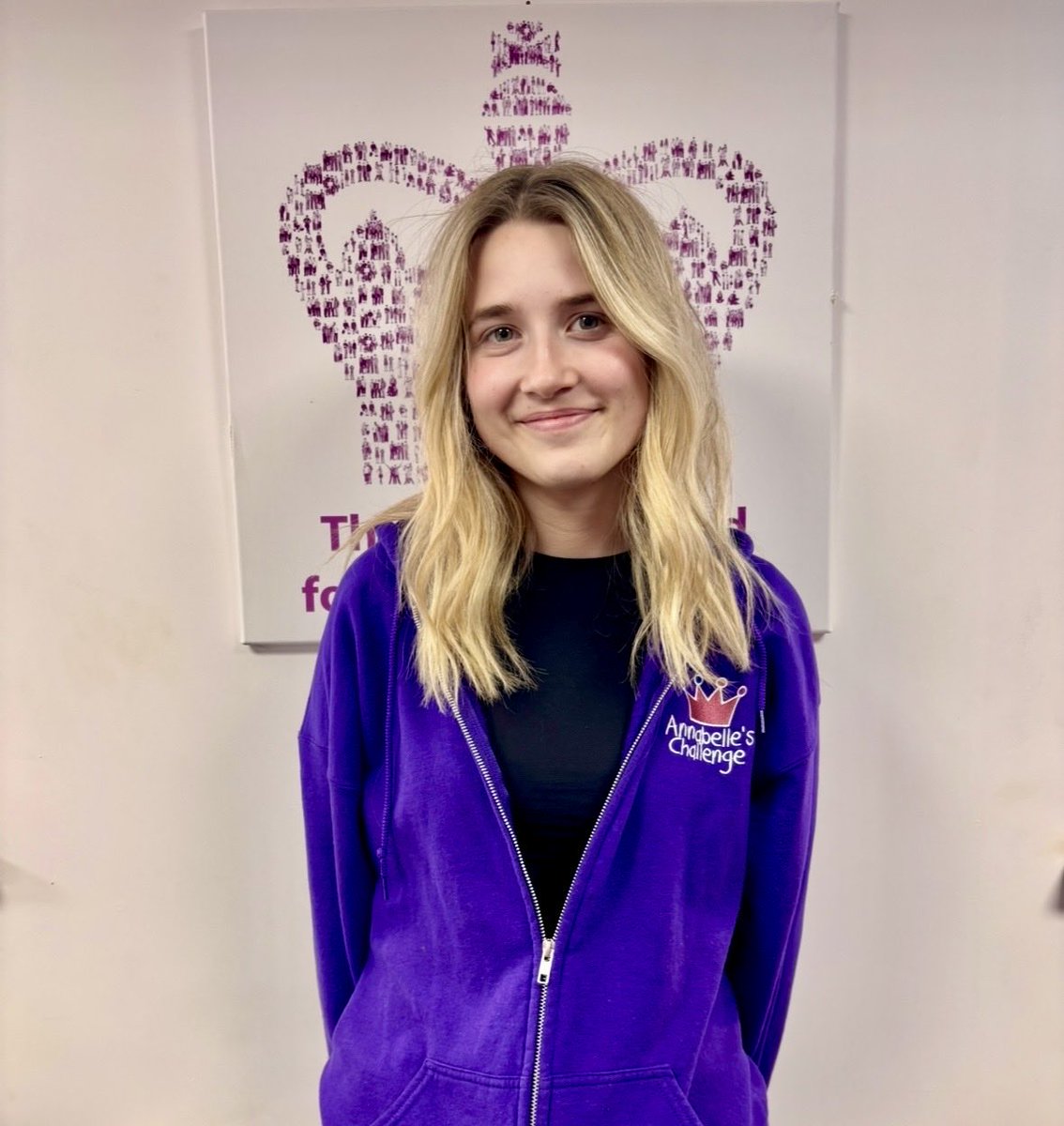 Annabelles Challenge Vascular EDS Charity tweet media