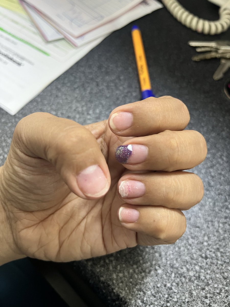 sofiamlandavazo's tweet photo. Estragos de la ansiedad Pt. 1 https://t.co/0AKkuaHGXY