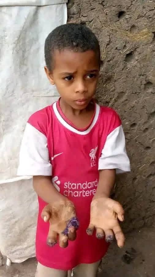Demand UN investigation, sanctions, and protection for Amhara children—retweet if you stand with them. #NeverAgain #SaveAmharaGirls #EthiopiaCrisis <a href="/UNHumanRights/">UN Human Rights</a>
<a href="/SecRubio/">Secretary Marco Rubio</a>
<a href="/ICRC/">ICRC</a>