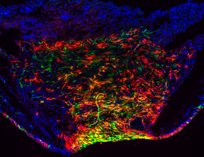 scisignal's tweet photo. A team has identified factors that drive the recruitment and activation of stem cells to repair skull bone injuries, suggesting defects in this pathway impair bone maintenance and regeneration in humans and contribute to disease. @dental_harvard @YYanglab https://t.co/WsJMGzcqHP https://t.co/pu29MzYPYb