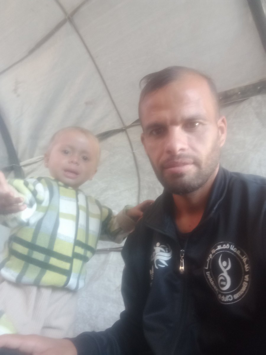 abad_gaza63710's tweet photo. My daughter needs to buy milk, calcium, vitamins and diapers. She suffers from malnutrition. Link 
https://t.co/X6EoSXRm96 https://t.co/dX2Dbeo0mk
