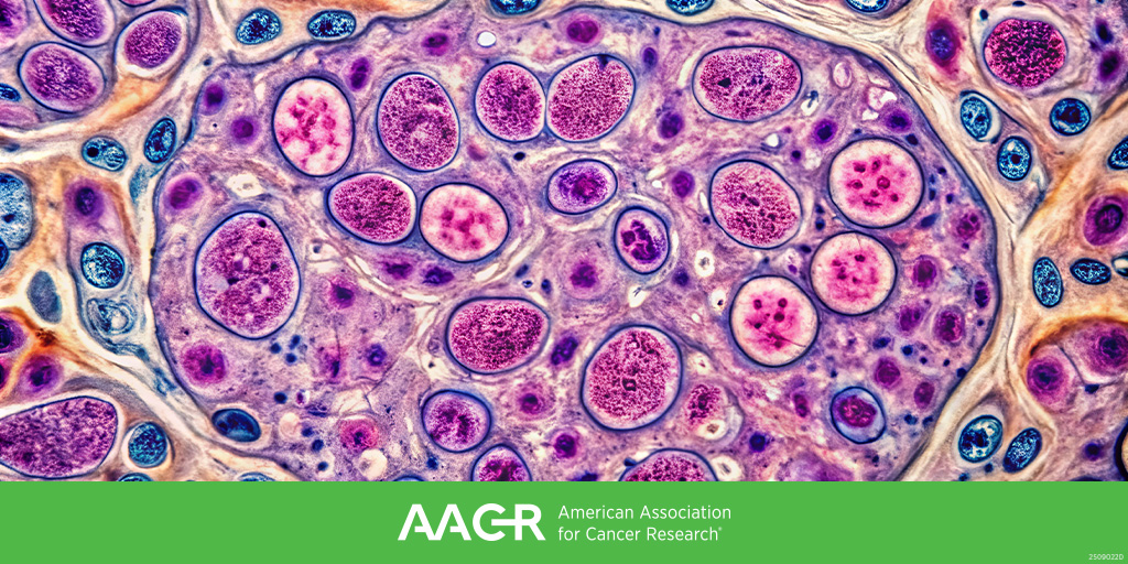 AACR's tweet image. Submit an abstract by December 4 for the AACR Special Conference on Innovations in Kidney Cancer Research (March 13-16; Philadelphia), chaired by Eric Jonasch, M. Celeste Simon, Samra Turajlic, and Qing Zhang. Learn more:
brnw.ch/21wWYHZ
#AACRkidney26 @QingZhangLab