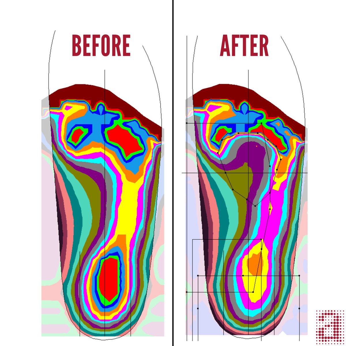 Amfit_a_'s tweet photo. Boot season looks good—but stiff soles don’t feel good.
Digital scans show how rigid soles shift pressure and strain joints. Amfit orthotic systems restore balance inside any style of boot. 
#FootHealth #Orthotics #Amfit https://t.co/o5E22CJIZN