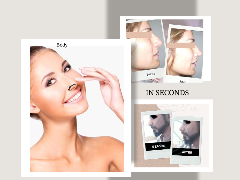 NoseSecret's tweet photo. 👃✨ Your best nose in minutes — for him or her!
Skip the surgery, keep the compliments 💕

💸 15% OFF $35+ with code NSF25 — expires 10/31
Order at https://t.co/R3pwPokavp 

#NoseSecret #InstantLift #ConfidenceInMinutes https://t.co/3ua4w83K0Y