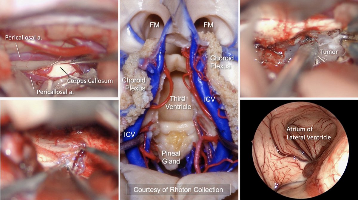 James K. Liu, MD tweet media