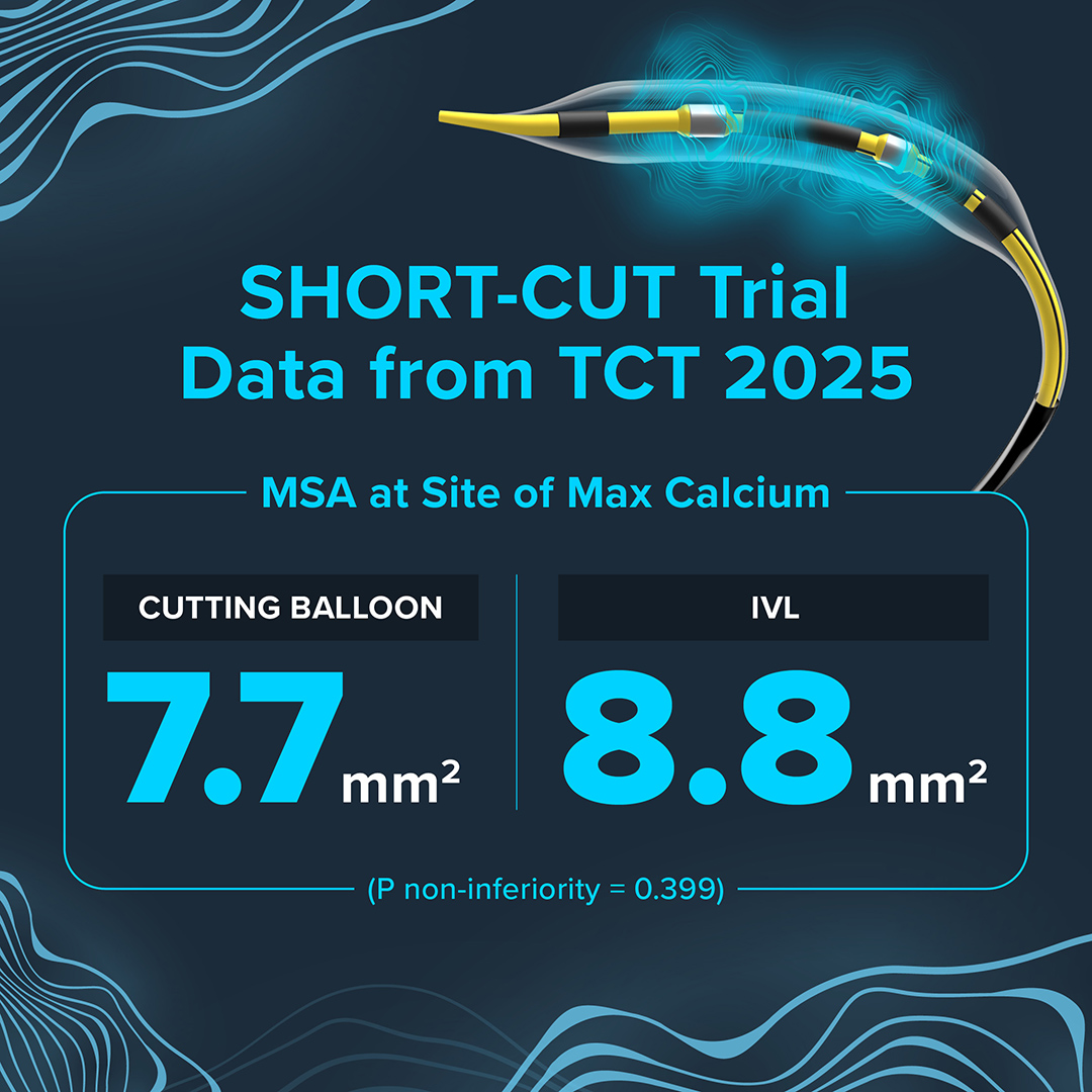 Shockwave Medical tweet media