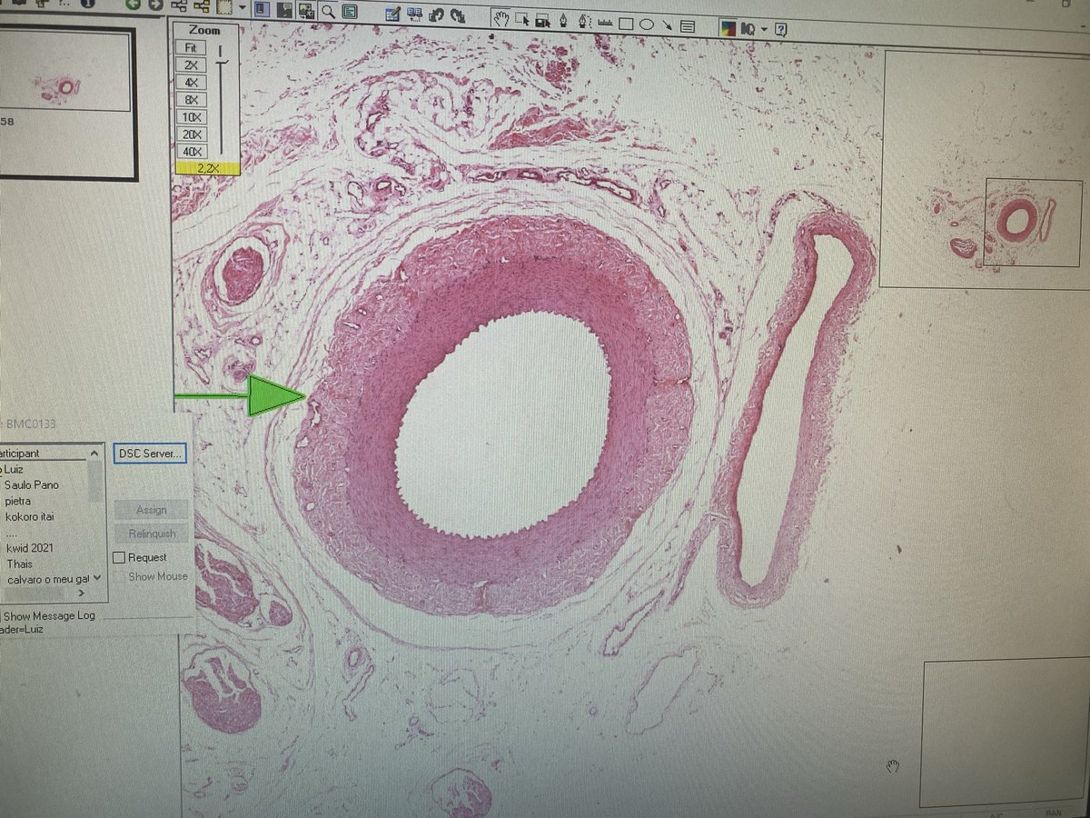 esqueceu de me bloquear na lâmina histológica de vasos