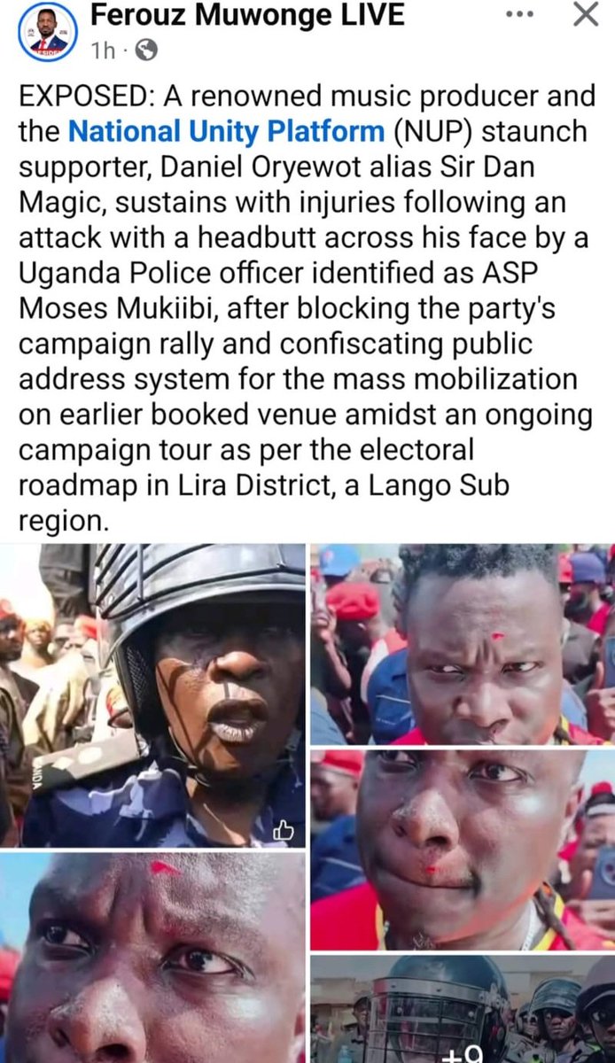 facebook.com/share/r/1B7aEa…
Elections must be safe. Justice Byabakama <a href="/UgandaEC/">The Electoral Commission - Uganda</a>, why are you quiet as #AfandeMukiibi <a href="/PoliceUg/">Uganda Police Force</a> harms civilians and campaign staff of <a href="/HEBobiwine/">BOBI WINE</a>? ...now injuring <a href="/SirDanMagic1/">Sir Dan Magic</a>? Investigate and protect the public. Silence is deadly! Stop impunity!