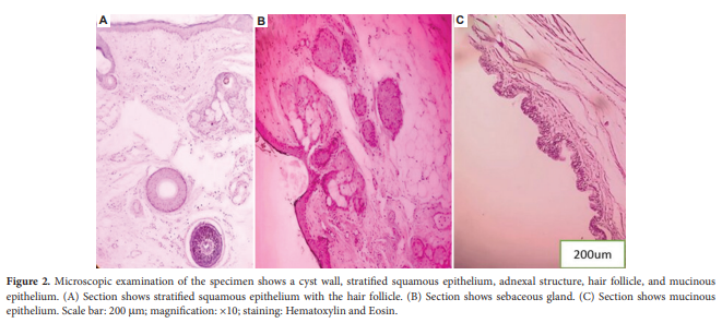 TD_ASP's tweet photo. 🥳New Case Report: Challenges and considerations in diagnosing mature teratoma during pregnancy: A case report
✍️By: Sumaira Siddiqui 
👀 Here: https://t.co/St6vH8gFnj https://t.co/NqWaxAmE0j