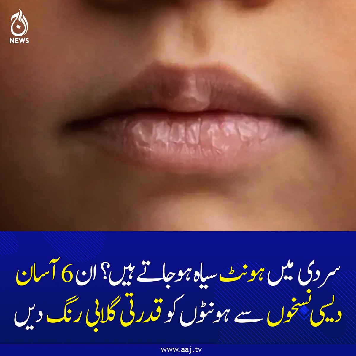 Aaj_Urdu's tweet photo. سرد�� میں ہونٹ سیاہ ہو جاتے ہیں؟ ان 6 آسان دیسی نسخوں سے ہونٹوں کو قدرتی گلابی رنگ دیں
https://t.co/wBHQg0SJO6
#AajNews #fblifestyle #wintercare #lipcare #beautytips #DesiTotkay #naturalremedies #pinklipstick #skincare #healthandbeauty #homeremedies https://t.co/Jc4tNLyCbj