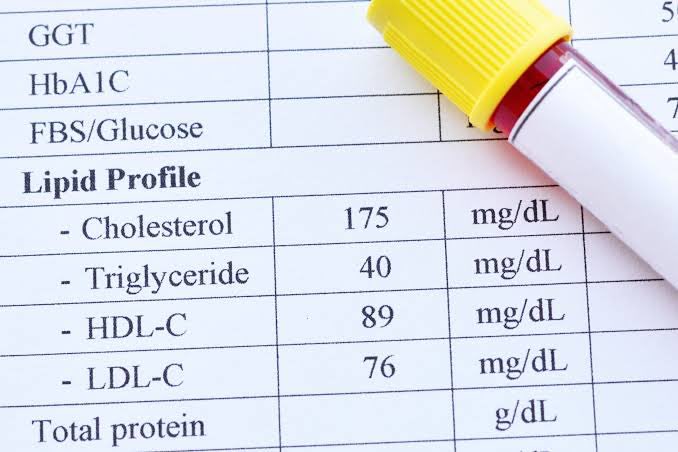 This is how your Lipid Profile should look like

✅ HDL - Higher is better

Optimal: ≥ 60 mg/dL

Acceptable: > 40 mg/dL (men), >50 mg/dL (women)

✅ LDL - Lower is better

Optimal (for low-risk individuals) < 100 mg/dL

Optimal (for high-risk individuals): < 70 mg/dL

✅ Lp(a) -