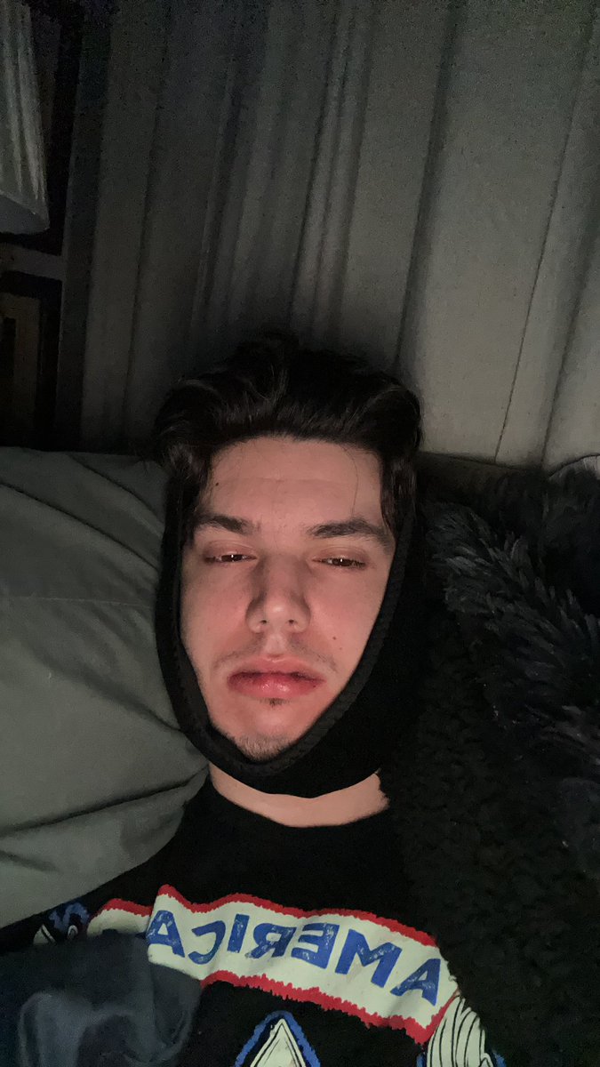 I’m in pain, but I survived :) 🦷