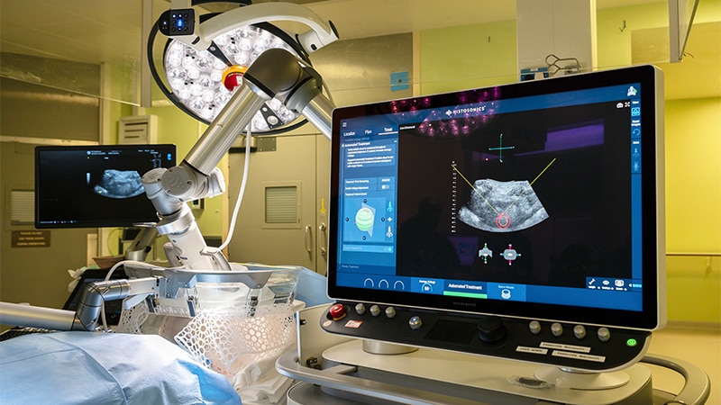 NHS Delivers First Histotripsy Treatment for Liver Cancer
ms.spr.ly/6016sCUha