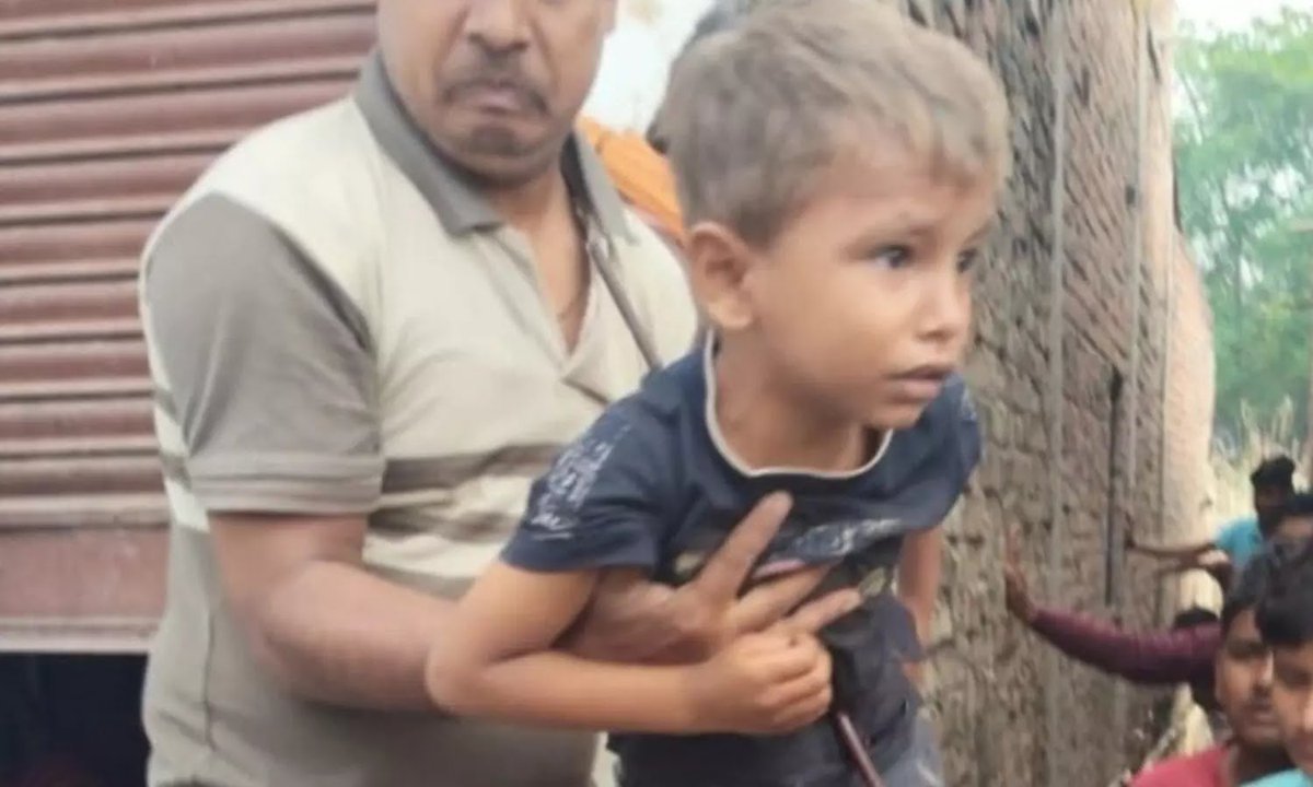 उत्तर प्रदेश के फतेहपुर जिले में एक हादसा हुआ है, जहां 5 वर्षीय जैन अपनी मौसी के यहां शादी समारोह में आया था।

खेलते समय वह छत से गिर गया और नीचे बने पिलर की सरिया उसके पेट से आर-पार हो गई। 

परिवारजनों और ग्रामीणों की मदद से सरिया को काटकर बच्चे को बाहर निकाला गया, बच्चे को