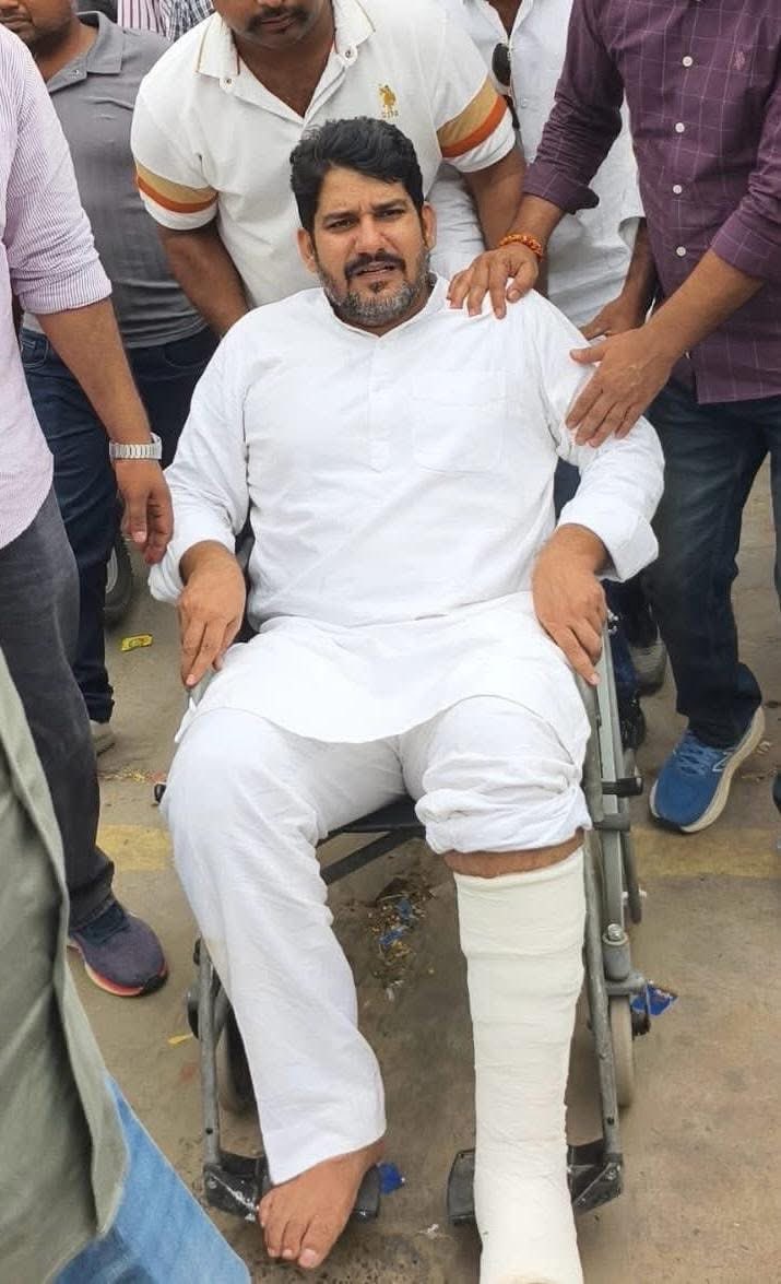 डीडवाना में कस्टोडियन भूमि किसानों को आवंटित करने के मुद्दे को लेकर चल रहे प्रदर्शन के दौरान पुलिस द्वारा किए गए बल प्रयोग से लाडनूं विधायक मुकेश जी भाकर के पैर में फ्रैक्चर होने की घटना अत्यंत निंदनीय है। 
<a href="/MukeshBhakar_/">Mukesh Bhakar</a>