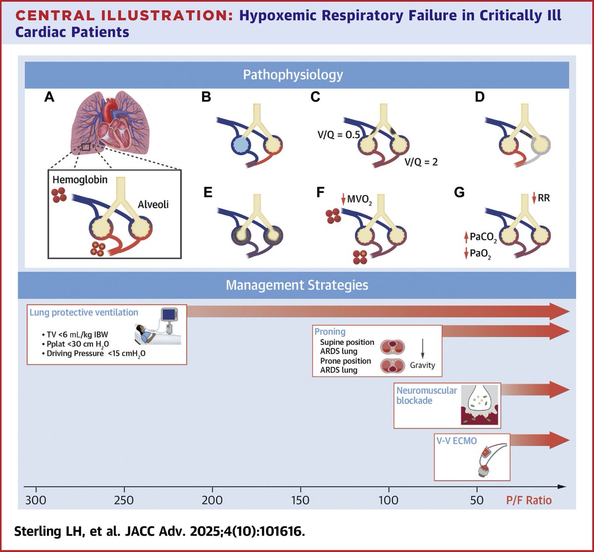 Today's Paper of the Day is:

Navigating Hypoxemic Respiratory Failure in Critically Ill Cardiac Patients

criticalcarereviews.com/latest-evidenc…

Join us to read 1 paper per day and stay up-to-date as we cover the spectrum of critical care across 2025