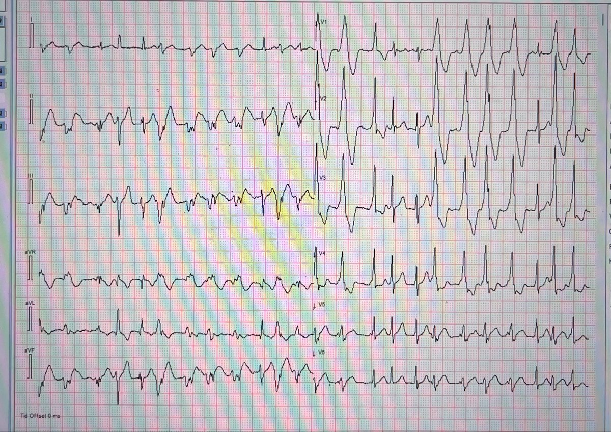 Magnus Nossen, MD tweet media