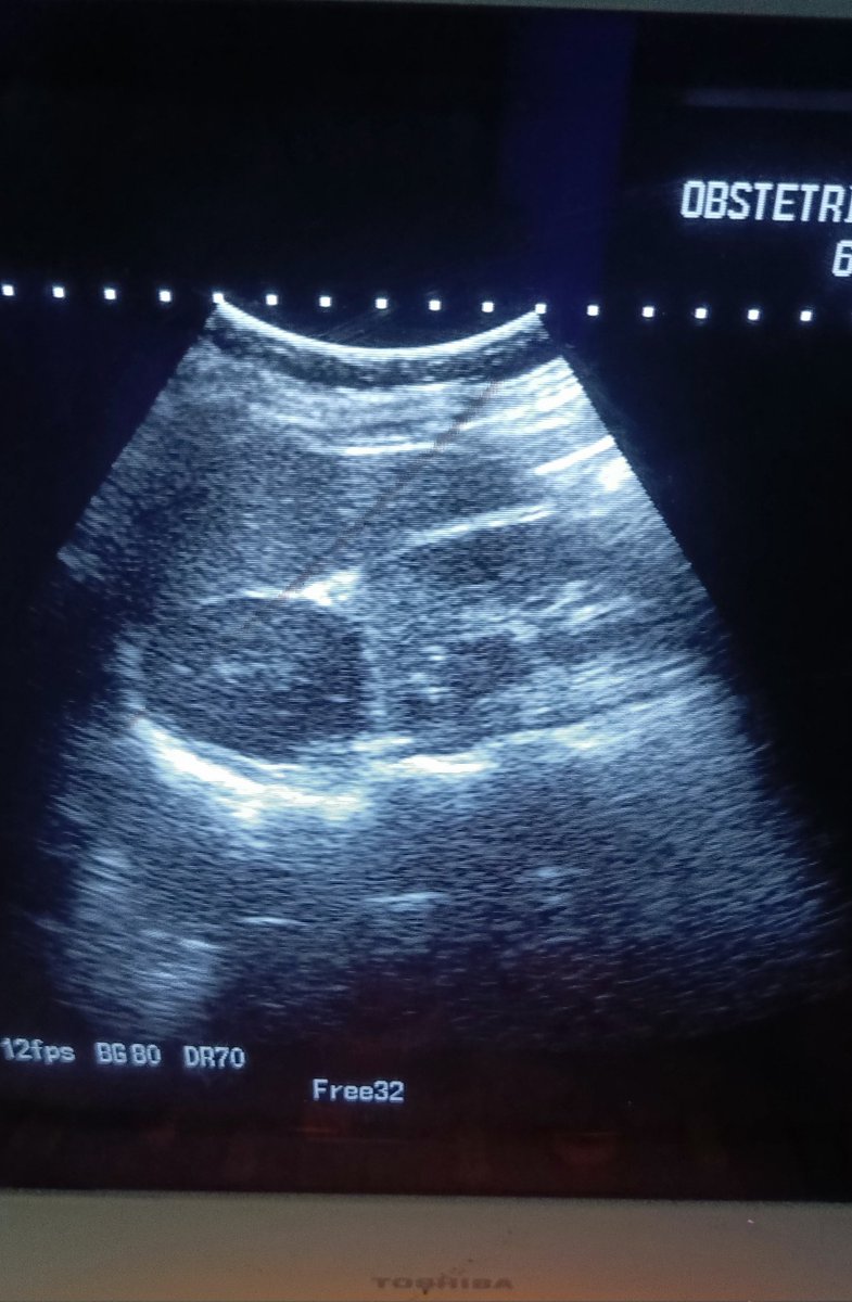 ChroRadGirlie tweet media