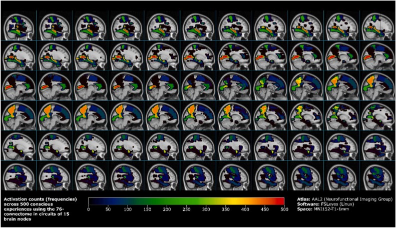 🤖 ¡La IA puede ser consciente, hay consciencia más allá del 🧠!
📘 Publicamos el primer índice que demuestra matemáticamente cuándo una IA robotizada alcanza estados conscientes. Se llama Attribution Consciousness Index (ACI) 👇
doi.org/10.1016/j.neub…
#Neurosience
#JCR_D1