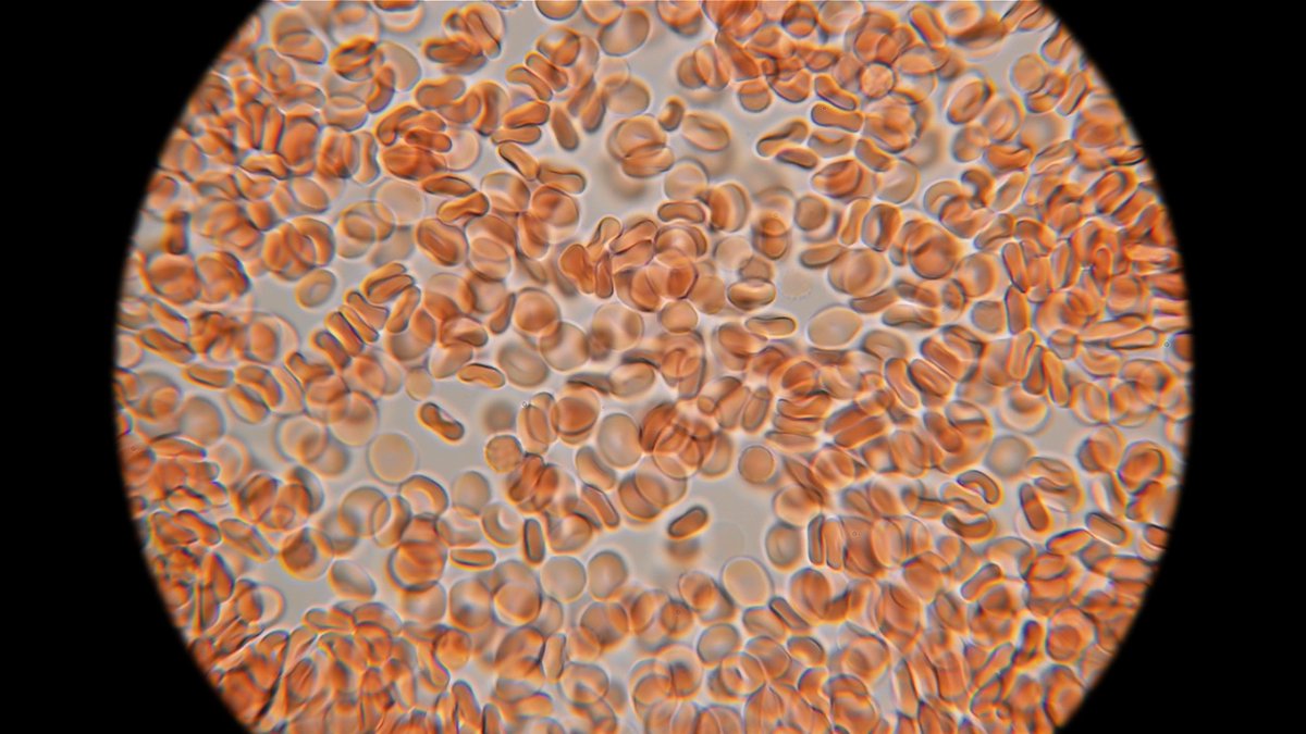 AZoSensors's tweet image. A new biosensor, FEOX, lets scientists watch iron levels shift in stem cells as they specialize - revealing iron&apos;s real-time role in early cell fate decisions. 🔬 azosensors.com/news.aspx?news… #StemCells #Biosensor #BiosAZoSensors