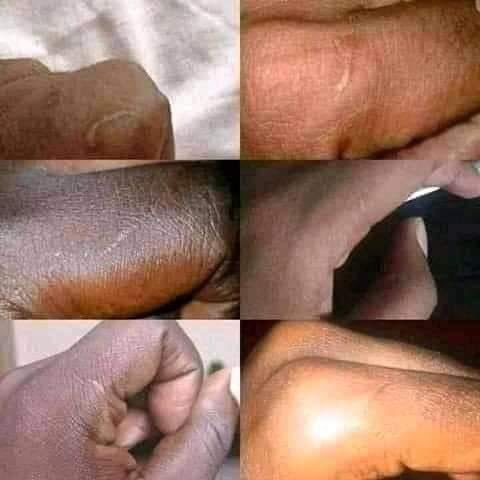 90% of black people have this scar on there left hand..

If you think I'm lying check...