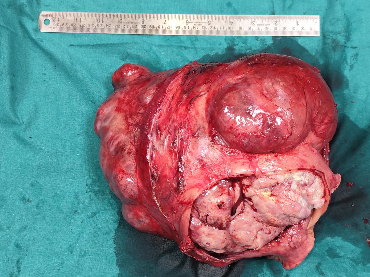 mahendra pal tweet media