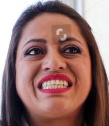 Amigos, una buena salud dental es señal de que te cuidas y te amas a ti mismo y de amor por los demás, para no ir asustando a la gente. 
Por favor, vayan a un dentista.