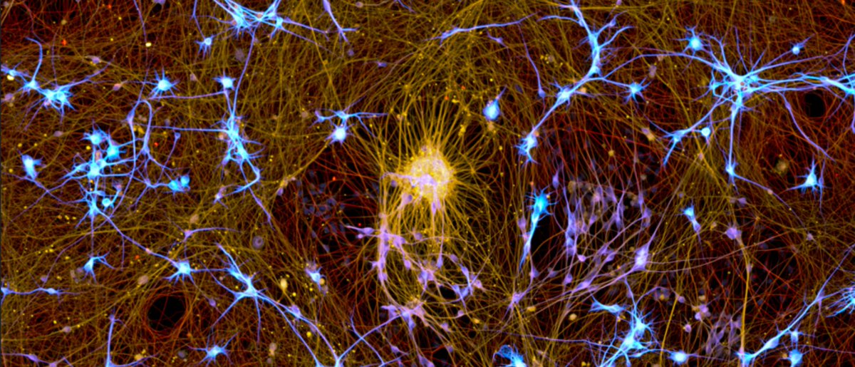 🔬 Meet the researcher behind the image that won the BioTechniques Image Competition 2025 📸

In this interview, we learn more about Bruno Cisterna, his winning image, his favorite microscopy techniques and his advice for burgeoning microscopists >>> biotechniques.com/imaging/meet-t…