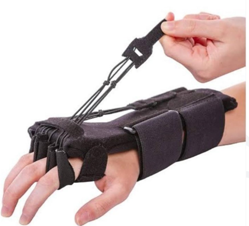 Doctors_GUILD's tweet photo. In which of the following nerve injuries is the instrument shown below used?

A). Radial nerve
B). Median nerve
C). Ulnar nerve
D). Volkmann's ischemic contracture https://t.co/sPxsbRXLmu