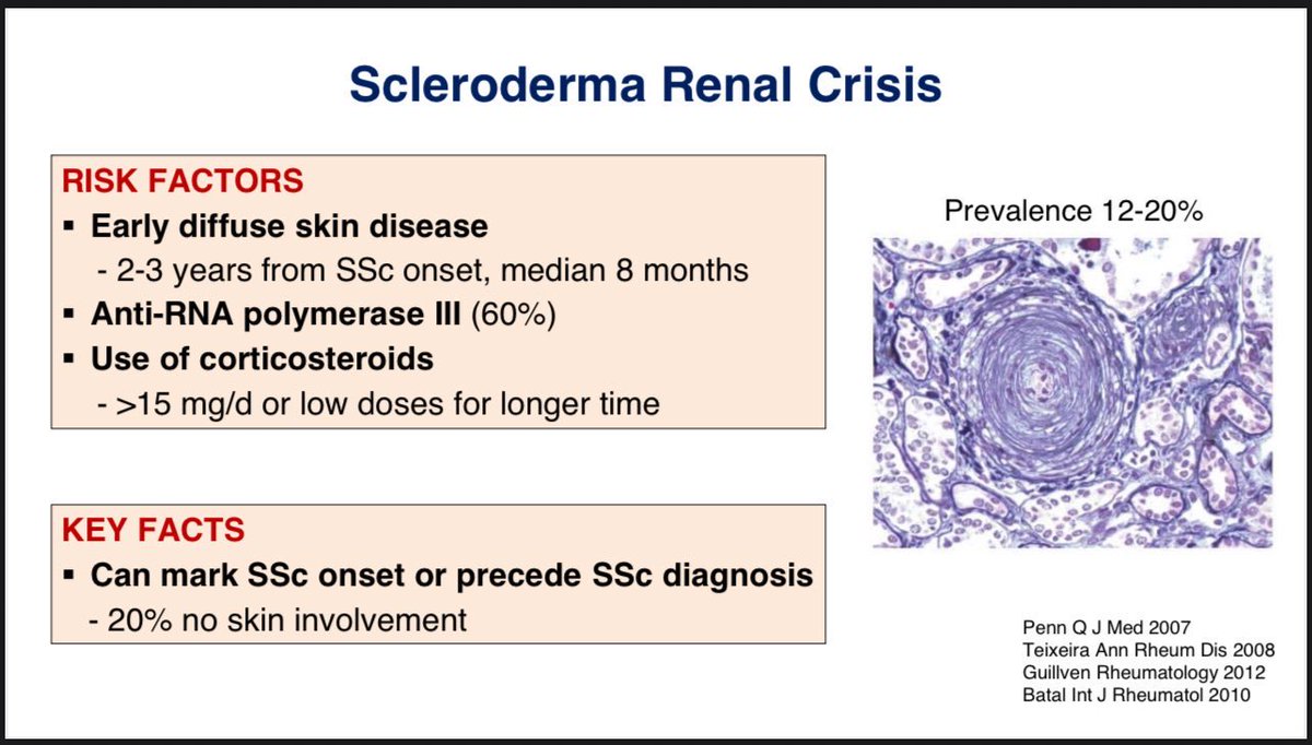 🩸 Scleroderma Renal Crisis (SRC)
A medical emergency that can herald the onset of systemic sclerosis - sometimes even before skin changes appear!

⚠️ Key risks:
•Early diffuse SSc
•Anti-RNA polymerase III (+)
•Corticosteroids >15 mg/day

📊 Prevalence: 12–20%
#Rheumatology