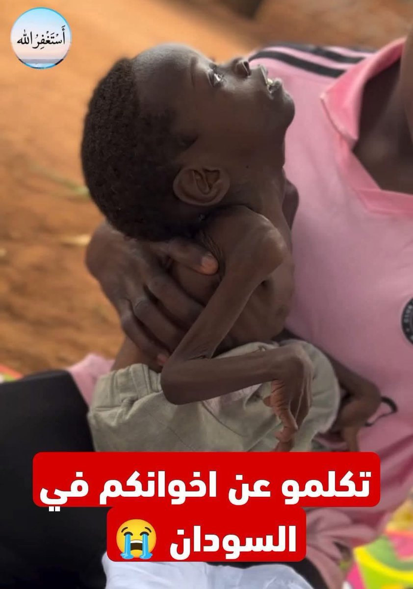 الإمارات التي عاثت في جنوب اليمن فساداً، تواصل اليوم مسلسل التدخلات في السودان. من تمويل المليشيات إلى إذكاء نيران الفتنة، النتيجة واحدة: شعوب تُركع بالجوع والتشريد. سياسة خارجية قوامها زعزعة الأمن وإشعال الحروب بالنيابة. التاريخ كفيل بتسجيل هذه الجرائم.
#اليمن_السودان
#الإمارات